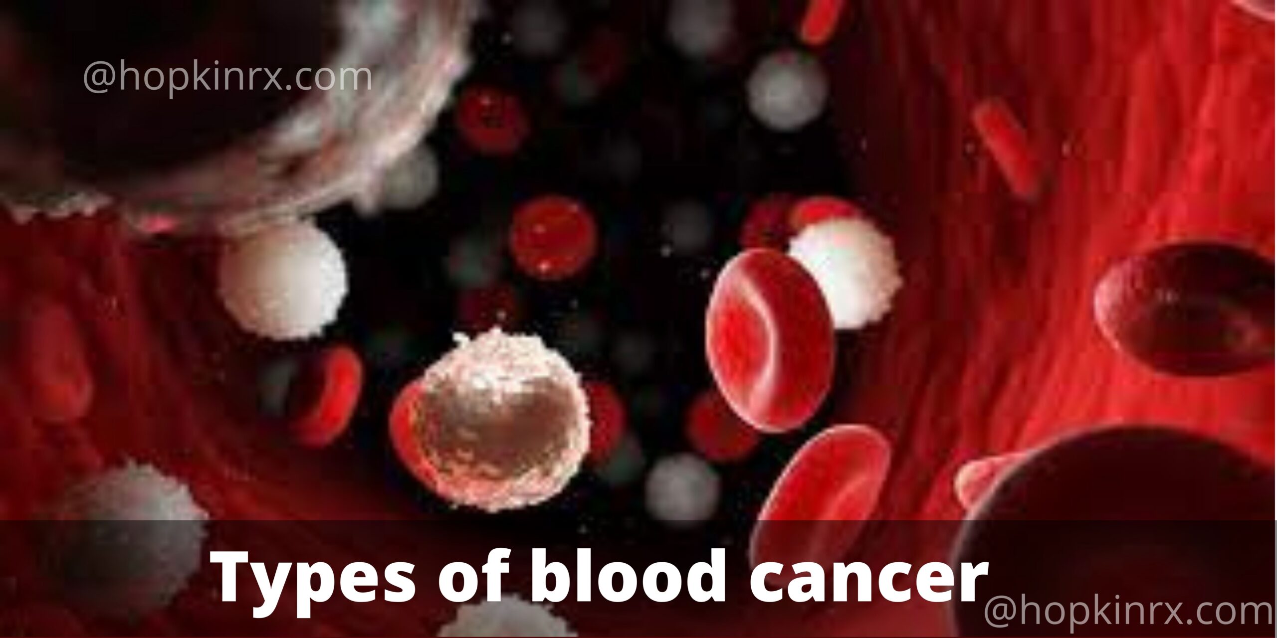 Types of blood cancer scaled