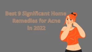 Best 9 Significant Home Remedies for Acne in 2022 (1)
