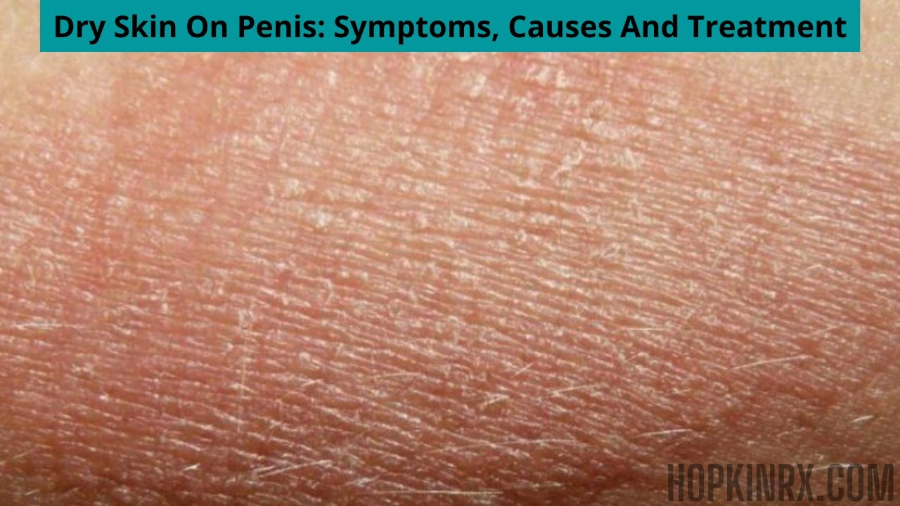 Dry skin on penis