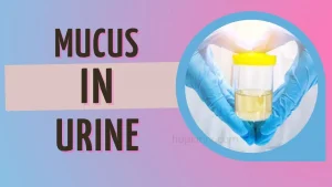 Mucus In Urine